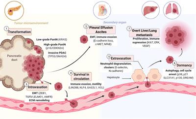 Pre-clinical Models of Metastasis in Pancreatic Cancer